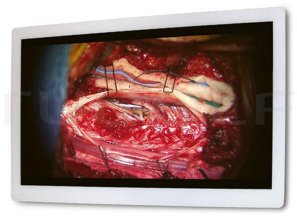 IM300-431 / 32 4K Uhd Medical Display, Lcd (Led) Auflösung 3840 x 2160, 4xsdi Gewicht 11.8 Kg, 773 x 478 x 75.2 mm