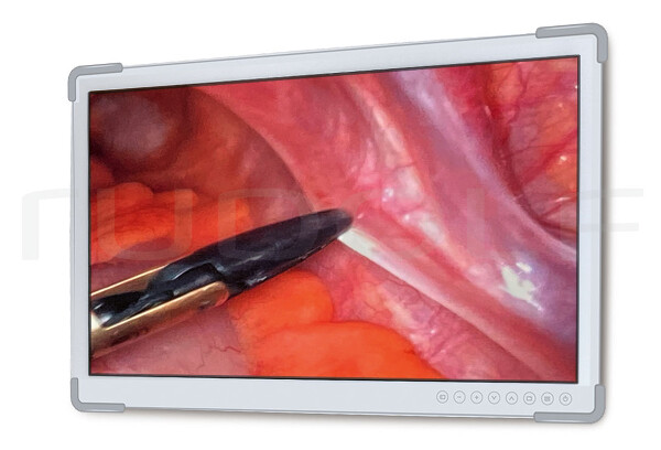 IM300-434 / 27 Hd Led Medical Display Auflösung 1920 x 1080, Farbe Weiss 673 x 425 x 75 mm, 8.52 Kg