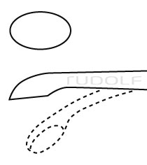 RU 5362-01 / Halle Curette, Flexible, Fig. 1, 21 cm - 8 1/4", 4,8 mm